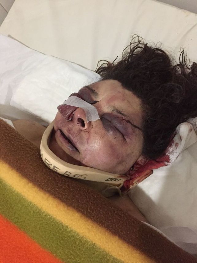 Así quedó la víctima después de la brutal agresión&nbsp;