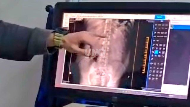 Detuvieron a dos “mulas” con 180 cápsulas de cocaína en un colectivo a la altura de Ceres