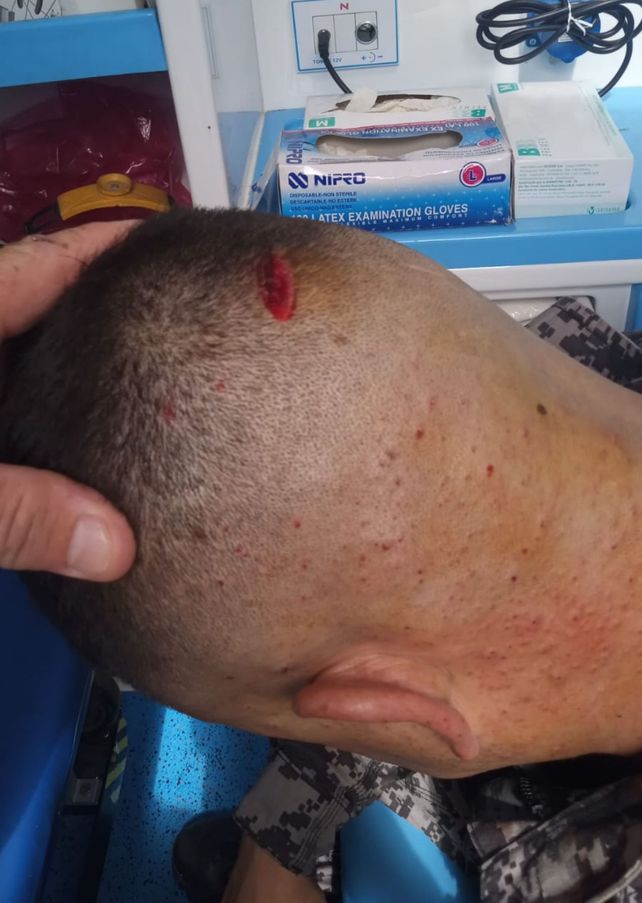 Un guardiacárcel resultó herido por el roce de una bala a la altura de la nuca.