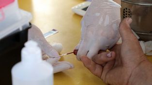 El diagnóstico oportuno es clave. En Argentina el 70% de las personas que conviven con el virus conoce su estado de salud.