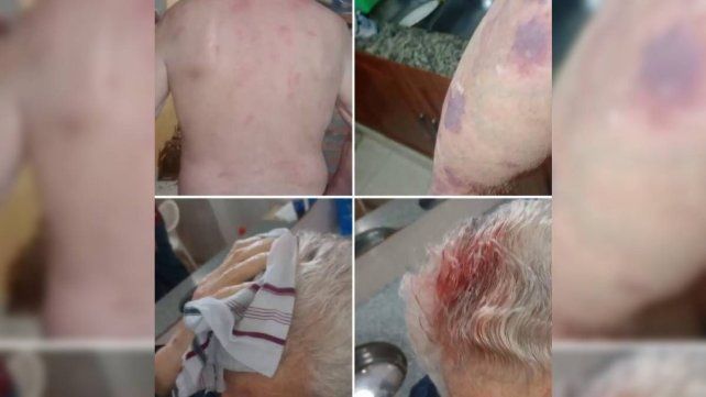 Destrozos en Villa Urquiza y heridos en María Grande generaron pico de demandas en compañías aseguradoras. Se prioriza reparación y aumento de coberturas