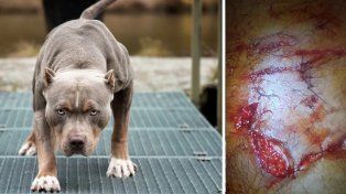 Un policía mató a un perro pitbull tras ser mordido en un operativo y por pedido del dueño del animal