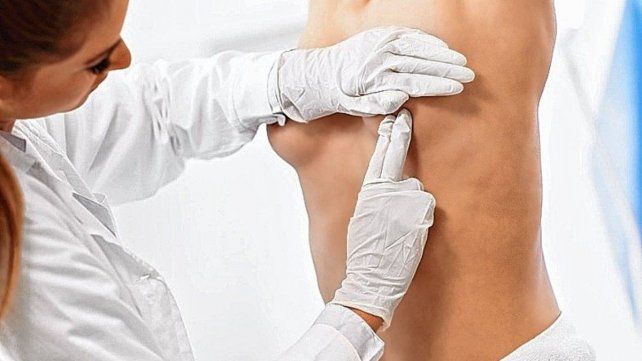 El diagnóstico. De cáncer de mama suele realizarse en estadios tempranos por hallazgos en los estudios de control (mamografía o ecografía)
