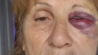 Un hombre golpeó salvajemente a su madre