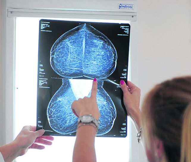 Mamografía. Los estudios deben hacerse en forma periódica.