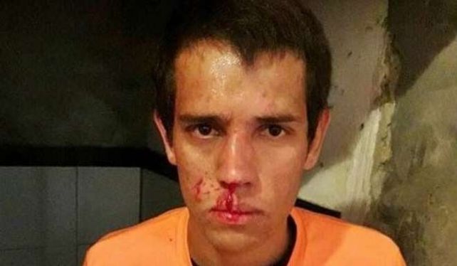 Cabezazo y piña a un árbitro en la Liga Concordiense