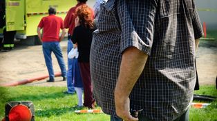 Confirman que la cirugía metabólica aumenta la sobrevida de personas con obesidad