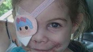 EEUU: Un restaurante echó a una niña por tener heridas en la cara