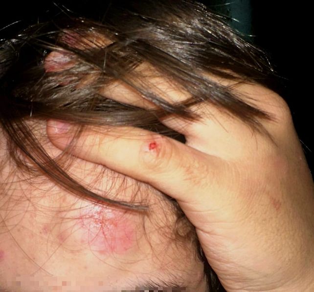 Brutal agresión en Santo Tomé: un hombre de 52 años golpeó con un palo a un adolescente tras una pelea entre perros