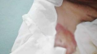 Le dieron 60 días de prisión preventiva al hombre que prendió fuego a su pareja