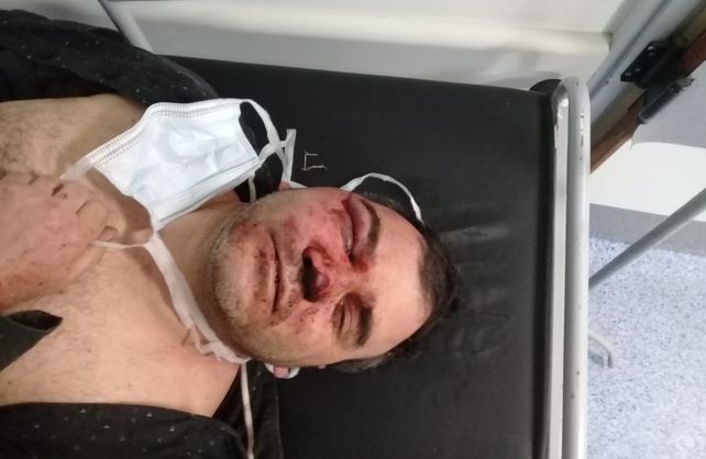 Nelson: riña y cuatro lesionados en una cancha de fútbol