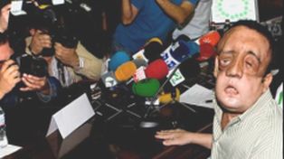 Paciente de trasplante de cara aparece en p&uacute;blico y anima a donantes