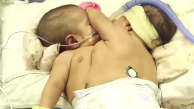 Video: Separaron con éxito a las Esmeraldas guatemaltecas