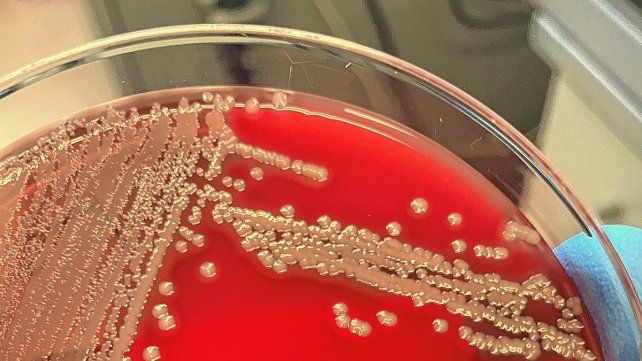 Notificaron 118 casos de Streptococcus Pyogenes en el país y ya son 16 los fallecidos por infección masiva