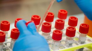 Tres departamentos concentran casi el 90% de los contagios