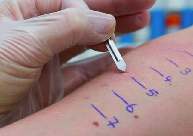 Prick Test. En 20 minutos