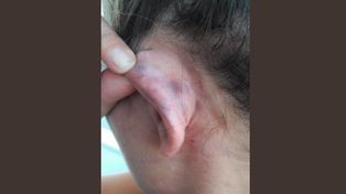 Una joven rosarina filmó el maltrato de su novio rugbier