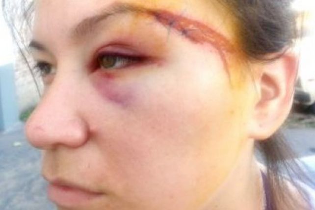 Violencia de género: brutal golpiza de un profesor de boxeo a su ex y a su cuñada