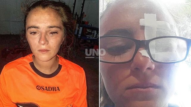 Una árbitra en la Liga Paranaense de Fútbol fue golpeada por jugadoras
