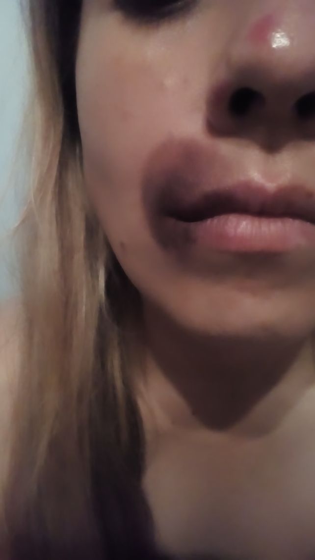 Virginia sufrió lesiones y moretones en la cabeza y el rostro.&nbsp;