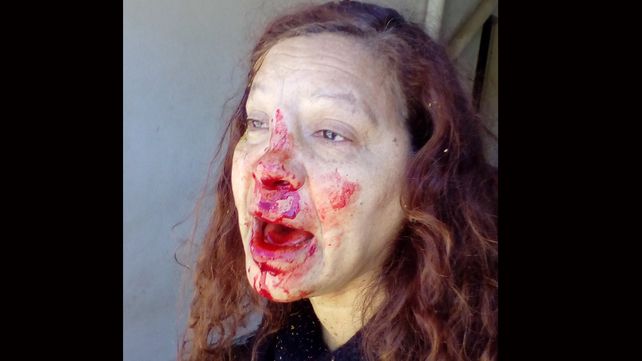 Una discusión entre vecinos terminó con una mujer salvajemente golpeada