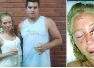 Una chica denunció que su novio le desfiguró el rostro por cómo bailaba