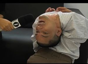 El curioso caso del hombre que nació con la cabeza al revés