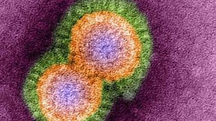 Científicos temen que se desate una pandemia humana de gripe aviar