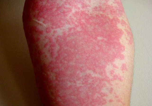 Afectadas. Las mujeres