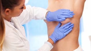 Cáncer de mama: qué se sabe de la novedosa vacuna contra el triple negativo