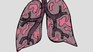 Hoy es el Día Mundial de la Tuberculosis