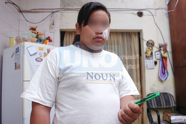 Una alumna de 12 años fue tajeada en el rostro por una compañera de curso