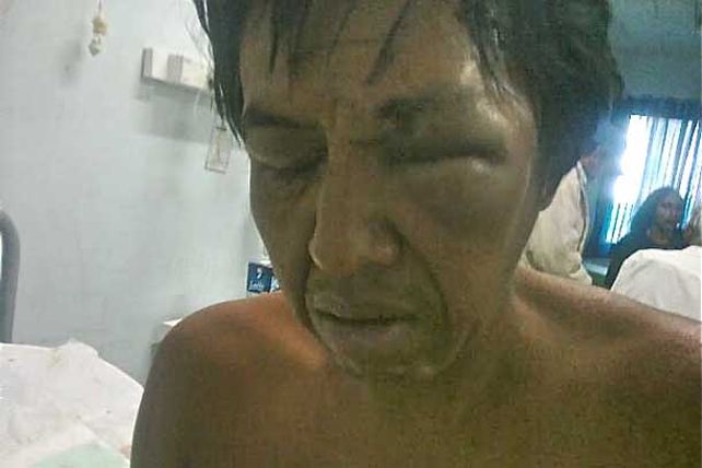 Golpearon e hirieron al hijo del cacique Félix Diaz