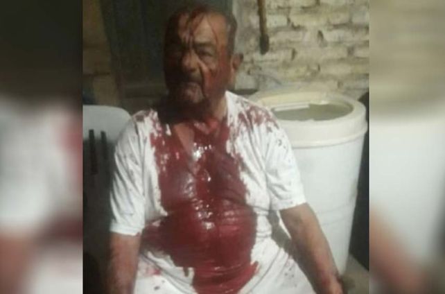 Golpearon salvajemente a un jubilado para robarle dos ollas, un celular y una garrafa