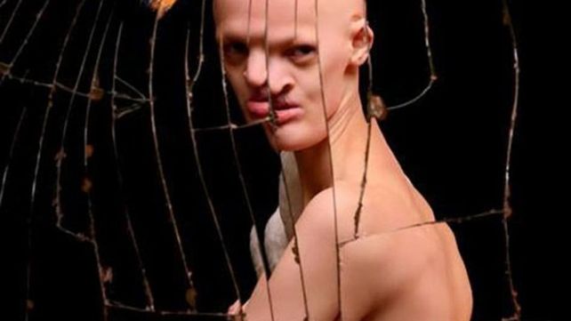 Conocé a la modelo internacional con una mutación genética única