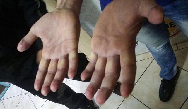El detalle de las manos de Pérez Corradi.