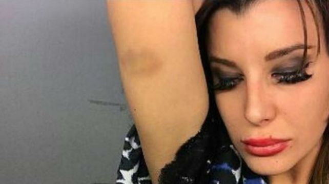 Charlotte Caniggia fue a la Justicia, publicó una foto con un moretón y la borró