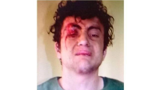 El joven que mató a su madre y su abuela había hecho un pozo, creen que para enterrarlas