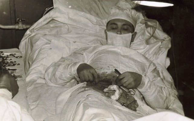 Valor a toda prueba. Leonid Rógozov en plena operación. Prescindió de un espejo y concretó la cirugía al tacto.