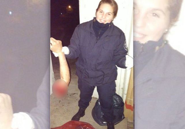 Macabro: policía se sacó una foto con el brazo de un accidentado