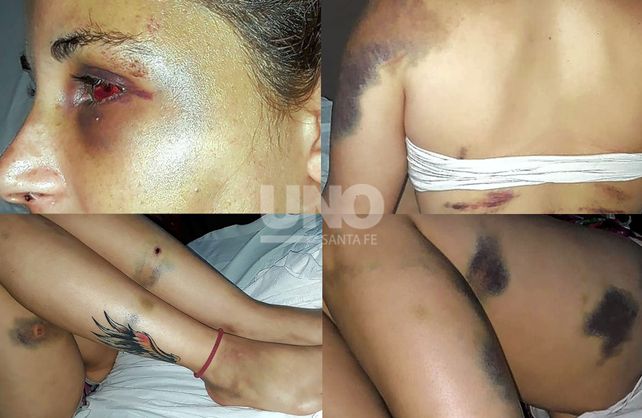 Las brutales lesiones sufridas por la víctima