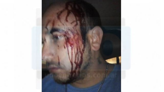 Agredieron violentamente a un colectivero