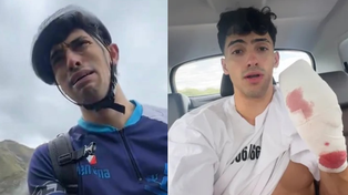 En sus redes sociales, el influencer mostró sus graves heridas