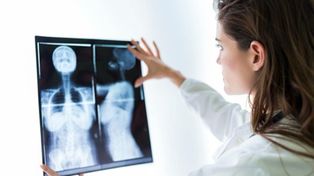 El cáncer crece y causará 9,6 millones de muertes en 2018