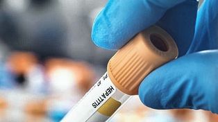 Alarma en Europa por el brote de hepatitis infantil