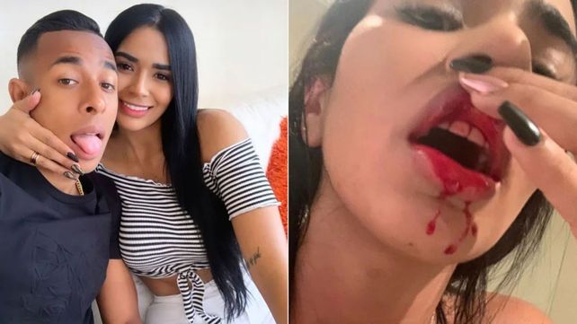 Daniela Cortés mostró en sus redes el daño que sufrió a manos del delantero de Boca.
