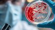 Cómo frenar el avance de las superbacterias en Rosario