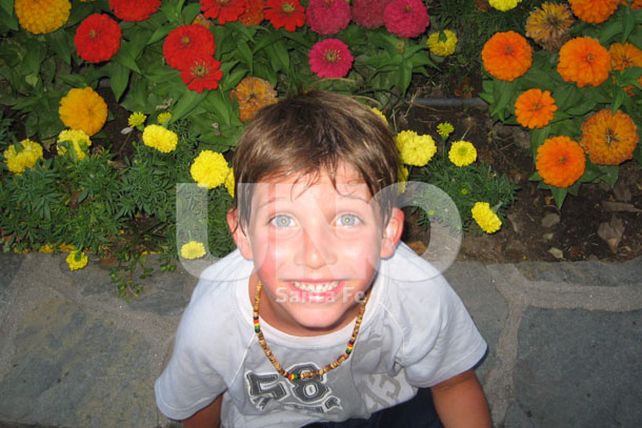 En el Alassia se realiza una cirugía cada siete días por mordeduras de perros