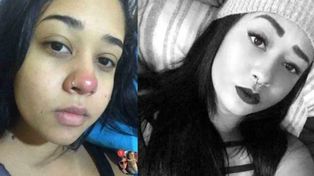 Quedó parapléjica por una infección a raíz de un piercing