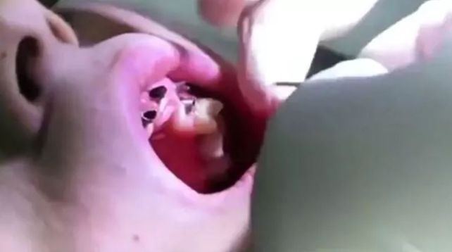 Mostró sus dientes luego de 20 años sin lavárselos